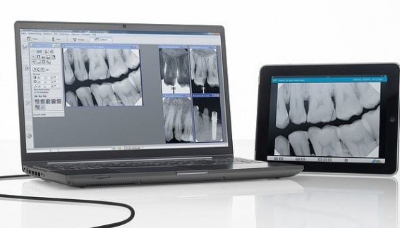 status radiologico endorale